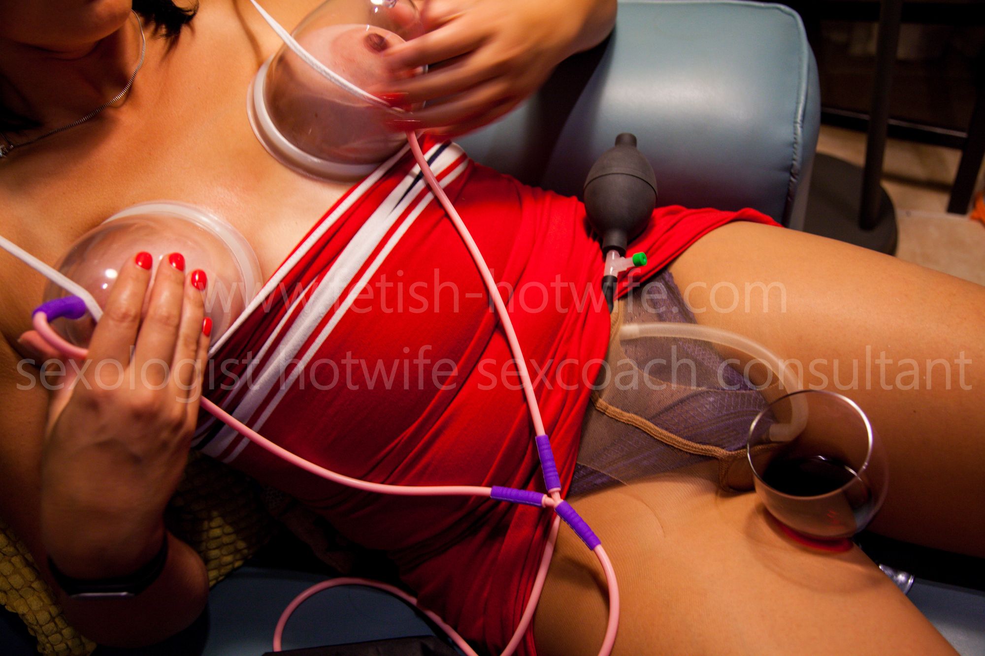 breast enlargement (augmentation) vacuum therapy